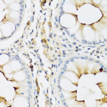 RNASE3 Antibody