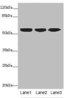 IHC-plus™ KRT10 / CK10 / Cytokeratin 10 Antibody (aa1-584)
