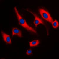 TNFAIP8 / SCC-S2 Antibody (Internal)
