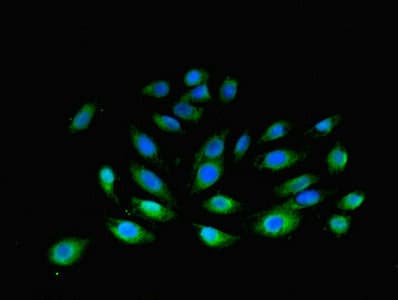 IHC-plus™ Polyclonal Rabbit anti-Human F3 / CD142 / Tissue factor Antibody (aa33-251, IHC)