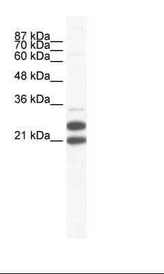 TRIM34 / RNF21 Antibody (aa49-98)