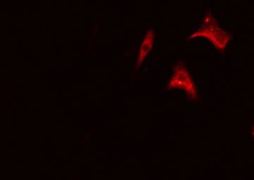 CML / BCR Antibody (phospho-Tyr177)