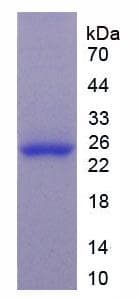 Human GSTP1 / GST Pi Protein (Recombinant His, N-Terminal)