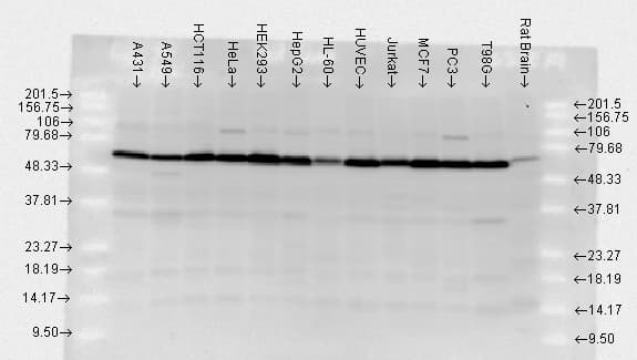 IHC-plus™ HSP70 / Heat Shock Protein 70 Antibody