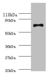 RECQ / DNA Helicase Antibody