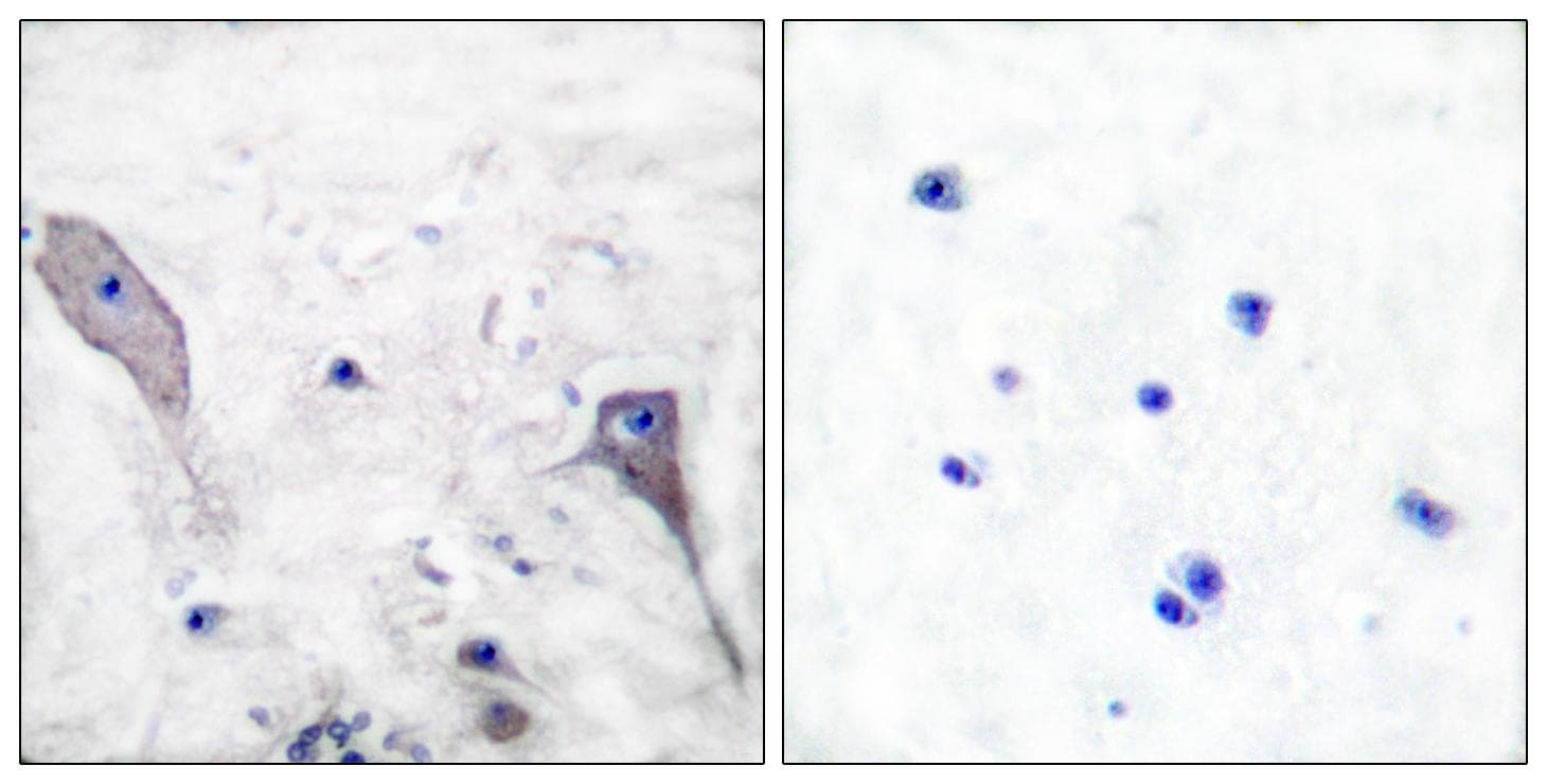 PTCH1 / Patched 1 Antibody