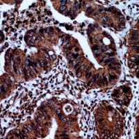 Polyclonal Rabbit anti-Human CAV3 / Caveolin 3 Antibody (IHC, WB)