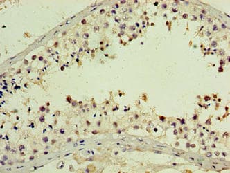 Polyclonal Rabbit anti-Human PNMA5 Antibody (WB)