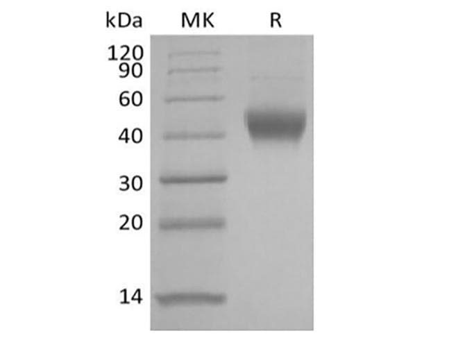 Human IL7R / CD127 Protein (Recombinant 6His, C-terminus)