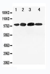 Polyclonal Rabbit anti-Human Mineralocorticoid Receptor Antibody (aa966-984, WB)