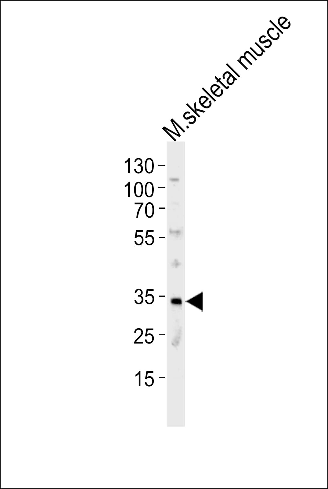 Polyclonal Rabbit anti-Mouse MOGAT2 Antibody (aa278-312, WB)