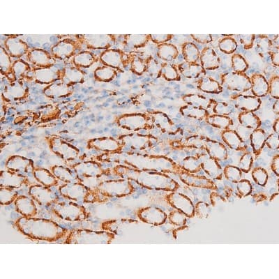 Polyclonal Rabbit anti-Human SYK Antibody (phospho-Tyr348, IHC, IF, WB)