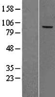 CFB / Complement Factor B Protein (Over-Expression Lysate Myc-DDK (Flag))