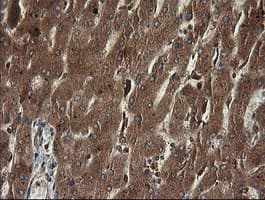 TAPBPL / TAPBPR Antibody (clone OTI4H5)