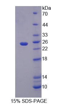Rat XRN1 Protein (Recombinant)