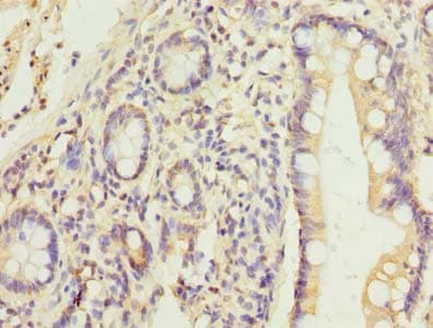 Polyclonal Rabbit anti-Human HEATR9 Antibody (IHC, WB)