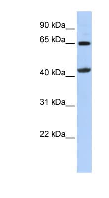 GATM / AGAT Antibody (aa251-300)