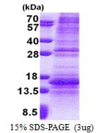 Human NDP Protein (Recombinant His)