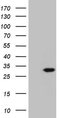 Monoclonal Mouse anti-Human NABP1 / OBFC2A Antibody (clone OTI7D9, WB)