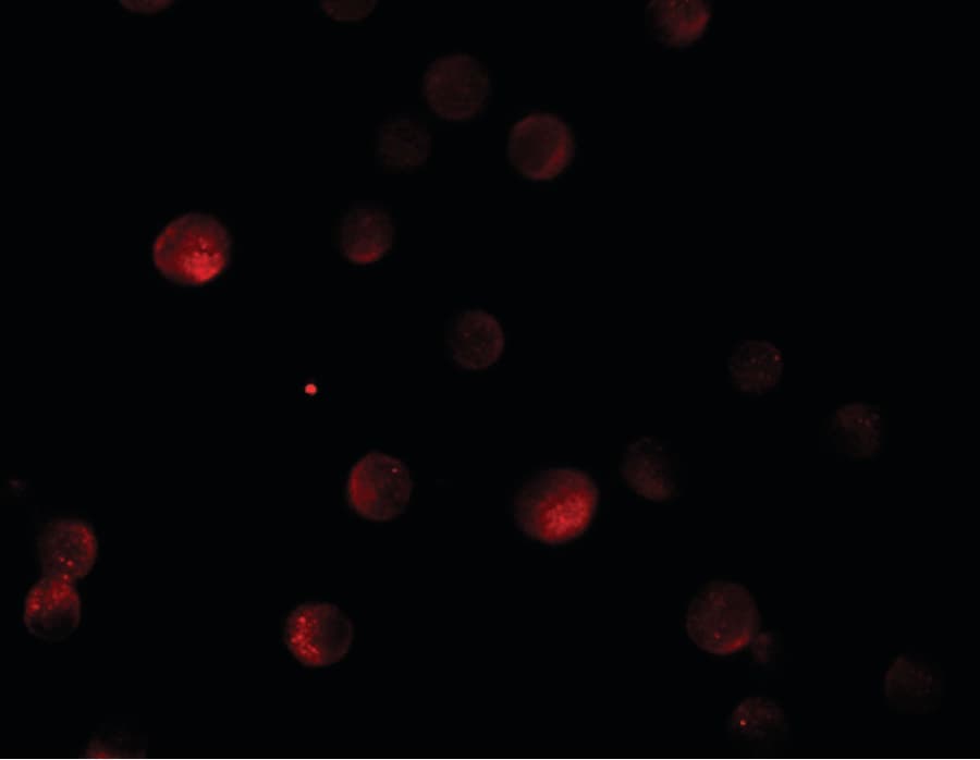 IHC-plus™ PAPPA2 / Pappalysin 2 Antibody