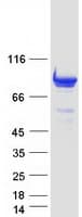 Human ADD2 Protein (Recombinant Myc-DDK (Flag))