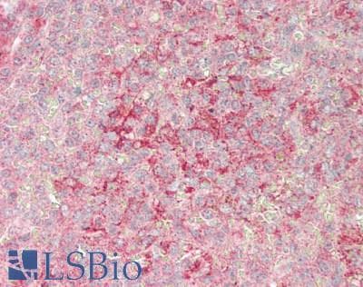 IHC-plus™ Polyclonal Rabbit anti-Human MCM10 Antibody (IHC, IF, WB)
