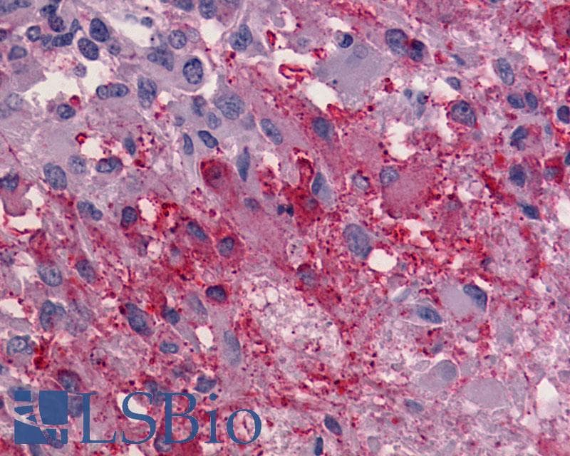 IHC-plus™ Polyclonal Rabbit anti-Human ADGRG1 / GPR56 Antibody (Cytoplasmic Domain, IHC)
