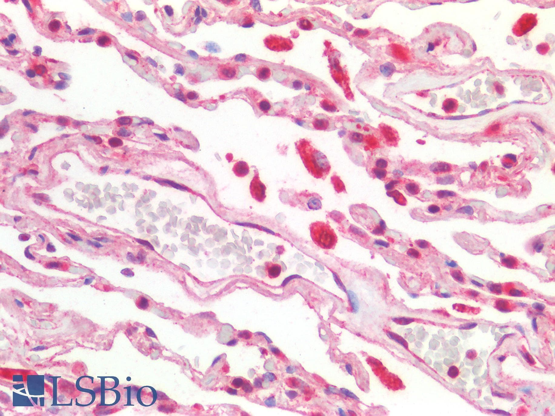 PathPlus™ Polyclonal Rabbit anti-Human ACE2 / ACE-2 Antibody (IHC, IF, WB)