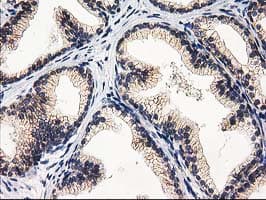 Monoclonal Mouse anti-Human EIF4E2 / IF4e Antibody (clone OTI1F2, IHC, WB)