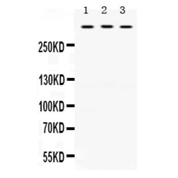 TNXB / Tenascin XB Antibody (aa3309-3337)