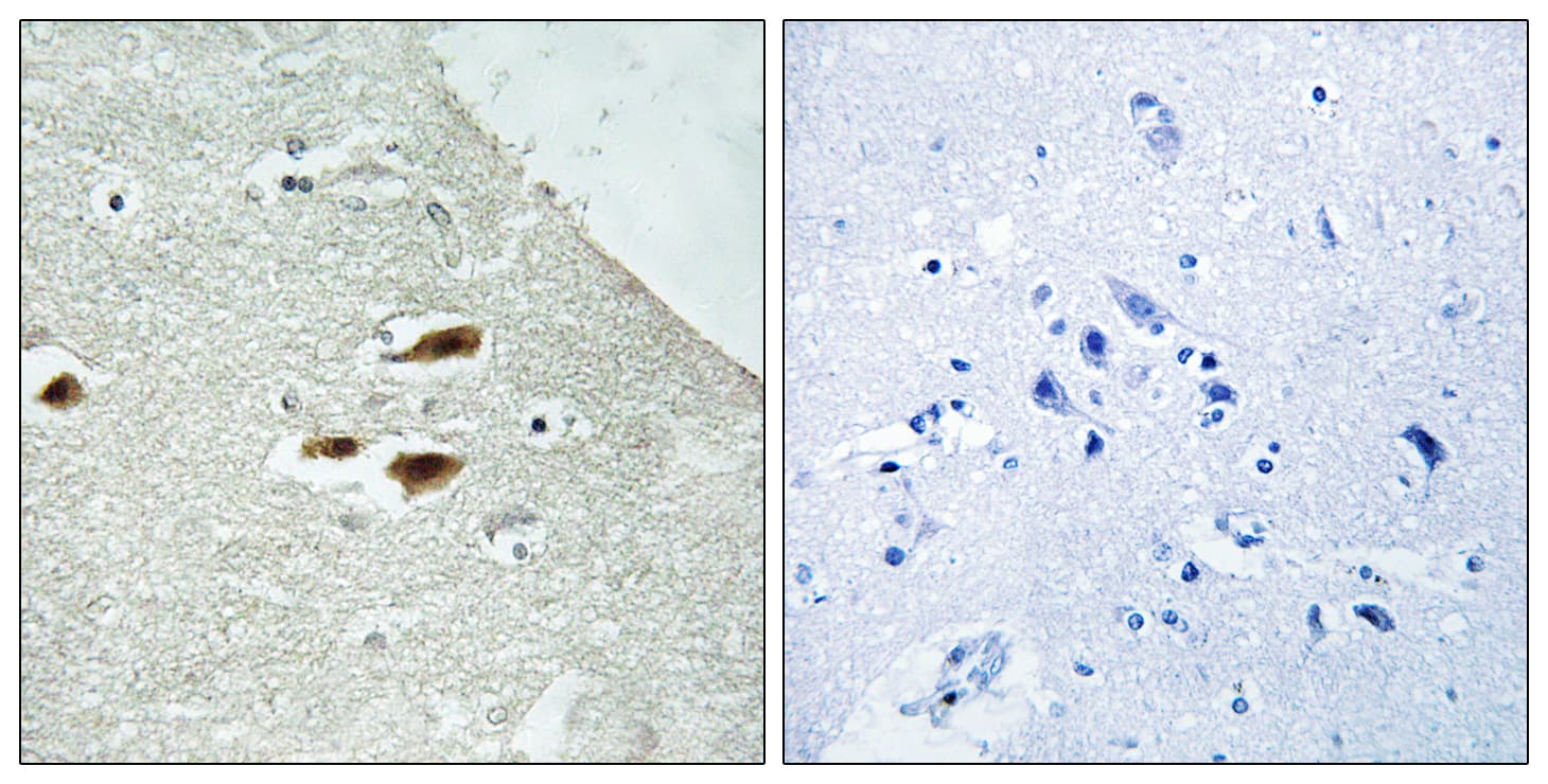 Polyclonal Rabbit anti-Human PER2 Antibody (phospho-Ser662, IHC, WB)