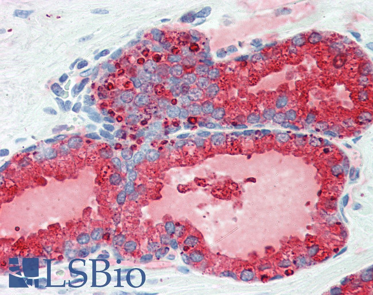IHC-plus™ Monoclonal Mouse anti-Human KLK3 / PSA Antibody (clone 5A11E2, aa26-251, IHC, WB)