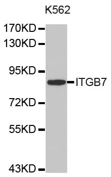 Polyclonal Rabbit anti-Human ITGB7 / Integrin Beta 7 Antibody (WB)