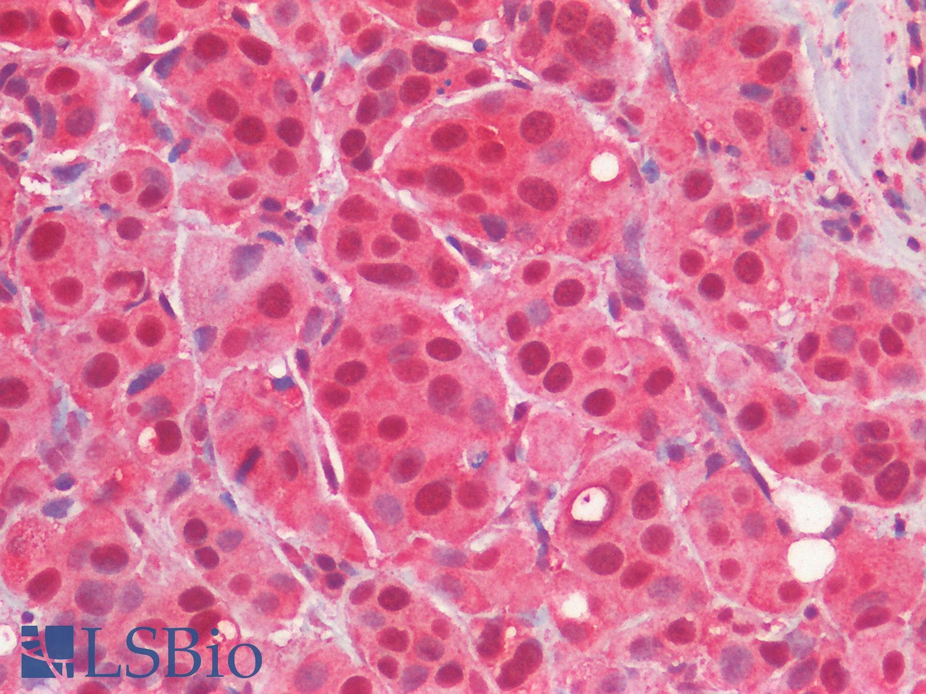 IHC-plus™ EGFR Antibody (C-Terminus)