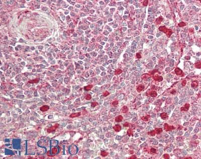 IHC-plus™ Polyclonal Rabbit anti-Human INPPL1 / SHIP2 Antibody (aa100-150, IHC, WB)