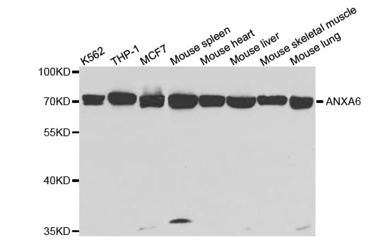 Polyclonal Rabbit anti-Human ANXA6/Annexin A6/Annexin VI Antibody (IHC, IF, WB)