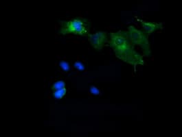 MAP2K1 / MKK1 / MEK1 Antibody (clone OTI3H3)