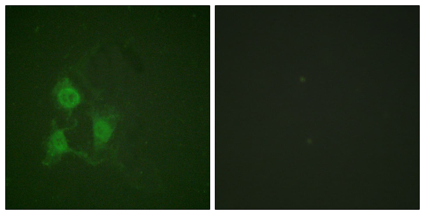 PRKACA + PRKACB Antibody (phospho-Thr197)