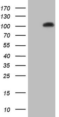 Monoclonal Mouse anti-Human NR3C1/Glucocorticoid Receptor Antibody (clone OTI6B5, aa1-265, IHC, WB)