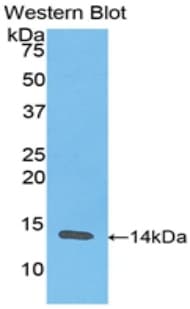 RETN / Resistin Antibody (aa17-108)
