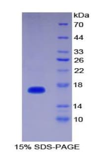 Human IL36RN / IL1F5 Protein (Recombinant His)