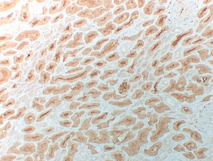 Monoclonal Mouse anti-Human HDAC6 Antibody (clone ABT-HDAC6, IHC)