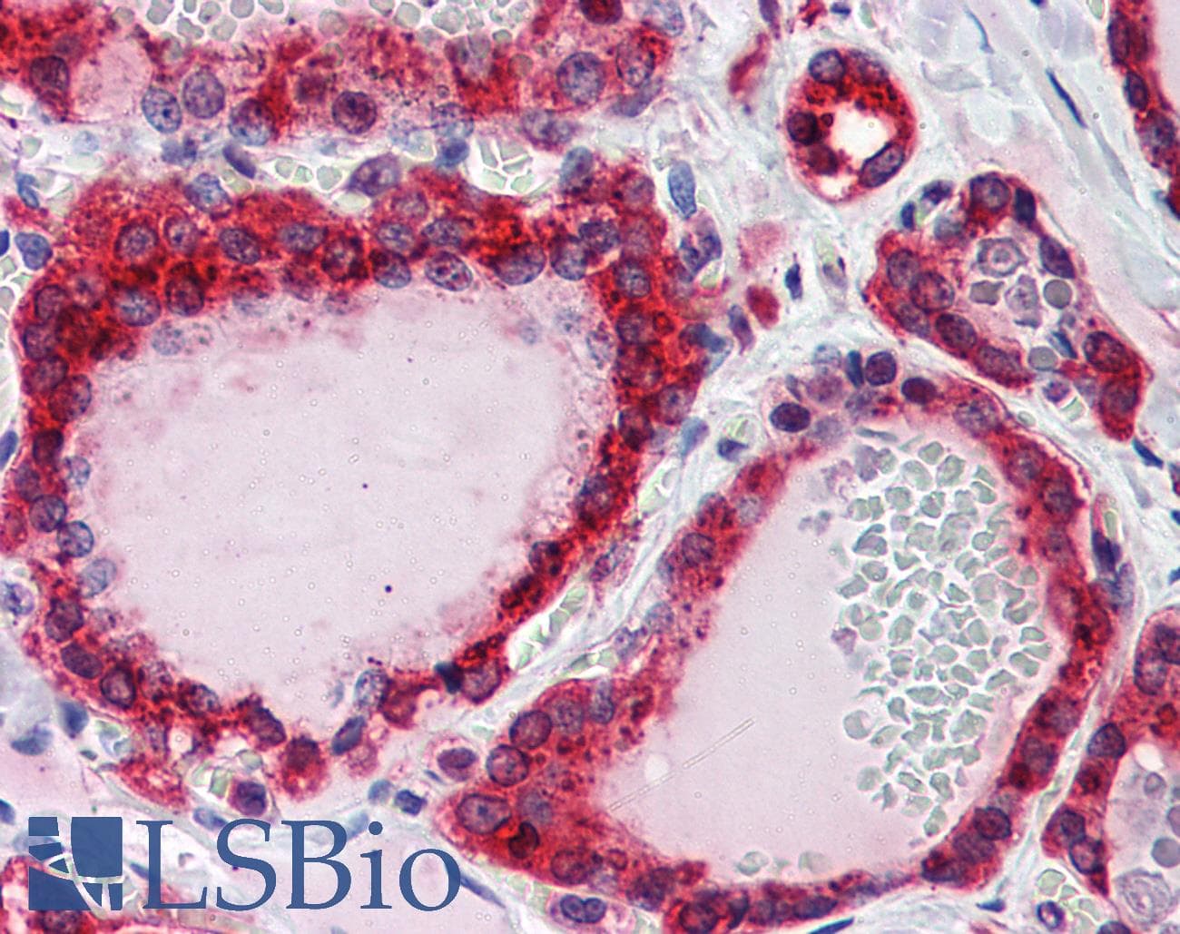 IHC-plus™ CTSD / Cathepsin D Antibody (clone 3F12-1B9)