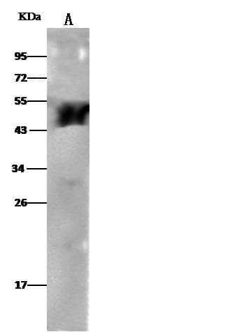Monoclonal Rabbit anti-Human ALDH3A1 Antibody (clone 316, Preservative Free, WB)