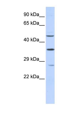 MEF2B Antibody (N-Terminus)