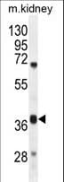 Polyclonal Rabbit anti-Human DUS4L Antibody (aa141-170, WB)