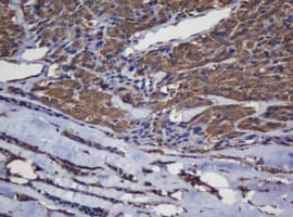 CRYAA / Alpha A Crystallin Antibody (clone OTI2C3)