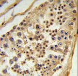 Polyclonal Rabbit anti-Human L1TD1 Antibody (aa817-848, IHC, WB)