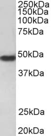 IHC-plus™ F2R / Thrombin Receptor / PAR1 Antibody (aa24-37)