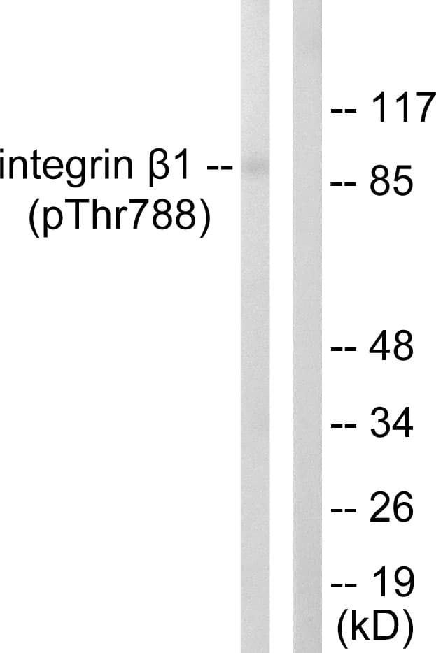 ITGB1 / Integrin Beta 1 / CD29 Antibody (phospho-Thr788)
